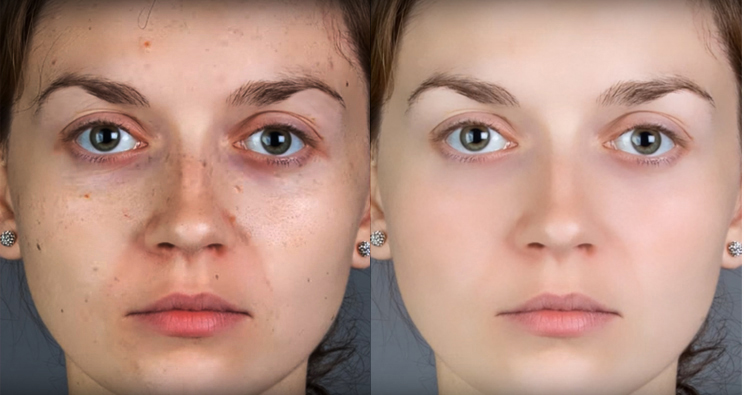 Retouch Foto